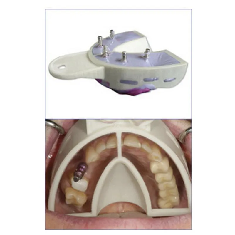 CUBETAS MIRATRAY IMPLANT SUPERIOR GRANDE