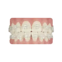 BRACKETS DPG ZAFIRO ROTH 